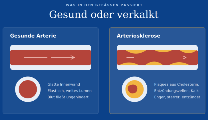 Arteriosklerose